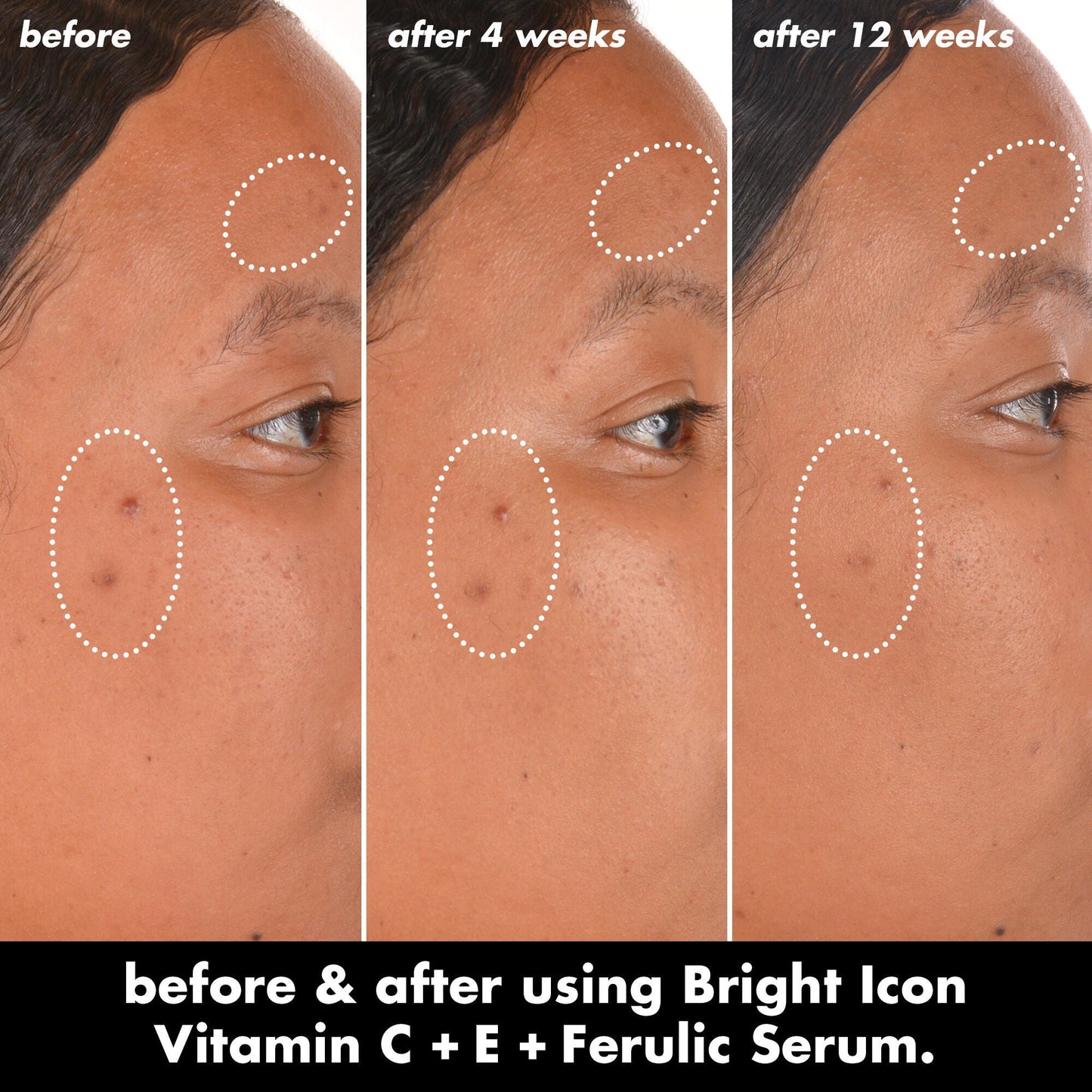 bright-icon-vitamin-c-e-ferulic-serum-e2 0226_EDU_BrightIconVitC_BA_Chanel_TRIPTYCH_c58f2fc8-209d-414f-9ba3-666a07a94887.jpg