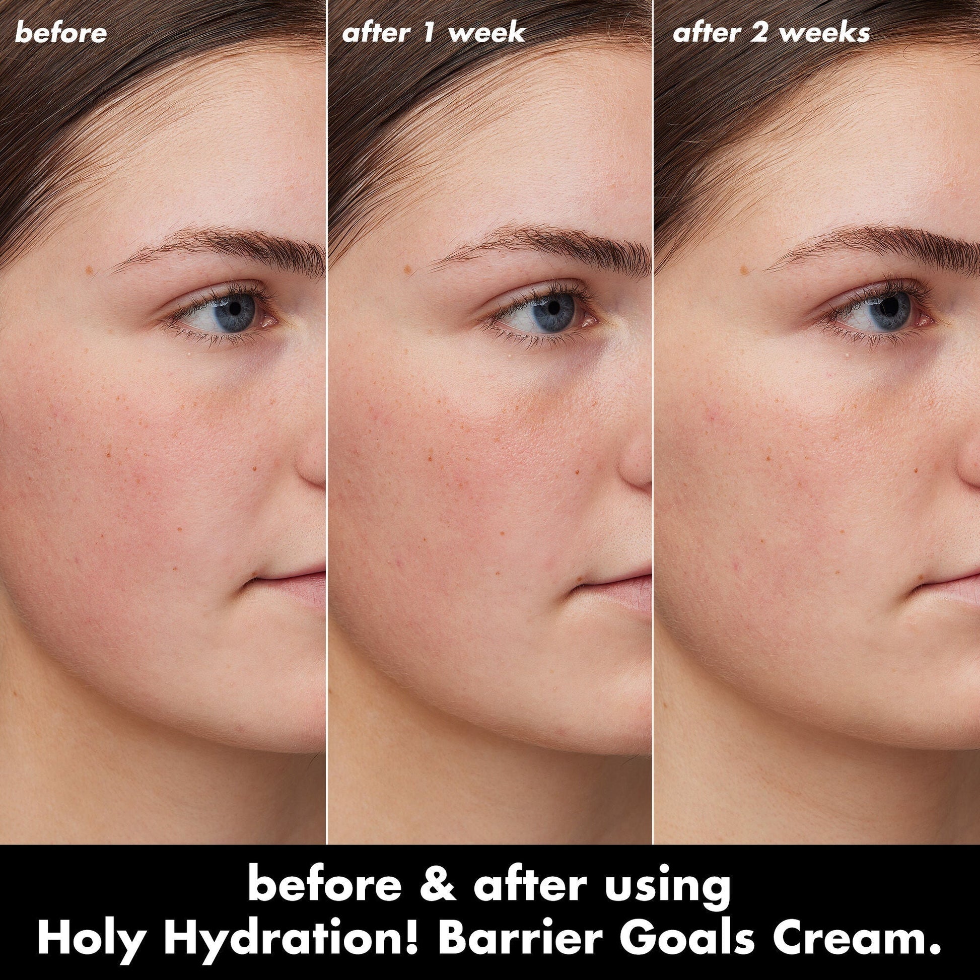 holy-hydration-barrier-goals-cream-a3 0226_EDU_HHBarrierGoalsCream_B_A_Zoe_TRYPTICH_710f5249-3a6b-41fd-89e4-817294dd9258.jpg
