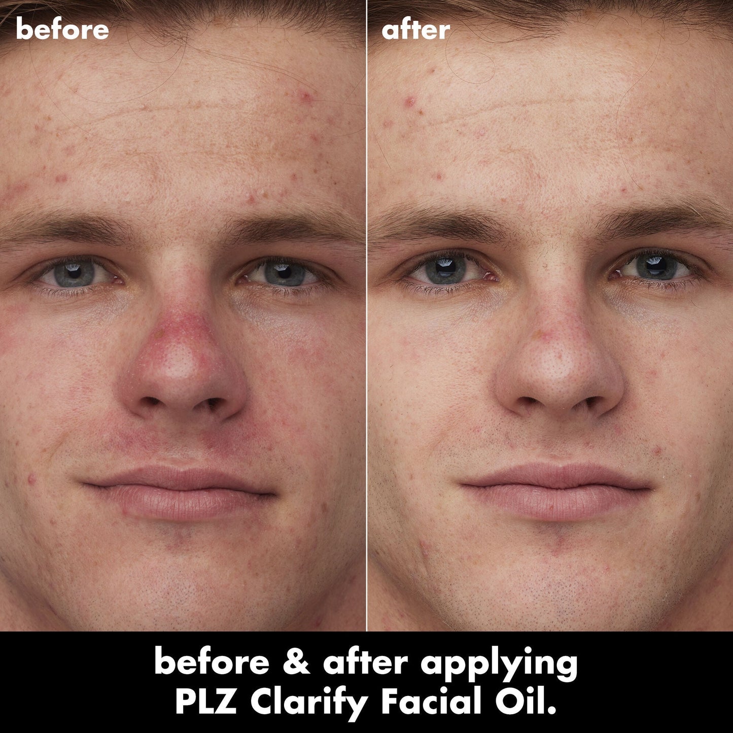 plz-clarify-facial-oil-o5 0326_EDU_PlzClarify_BA_Caleb.jpg