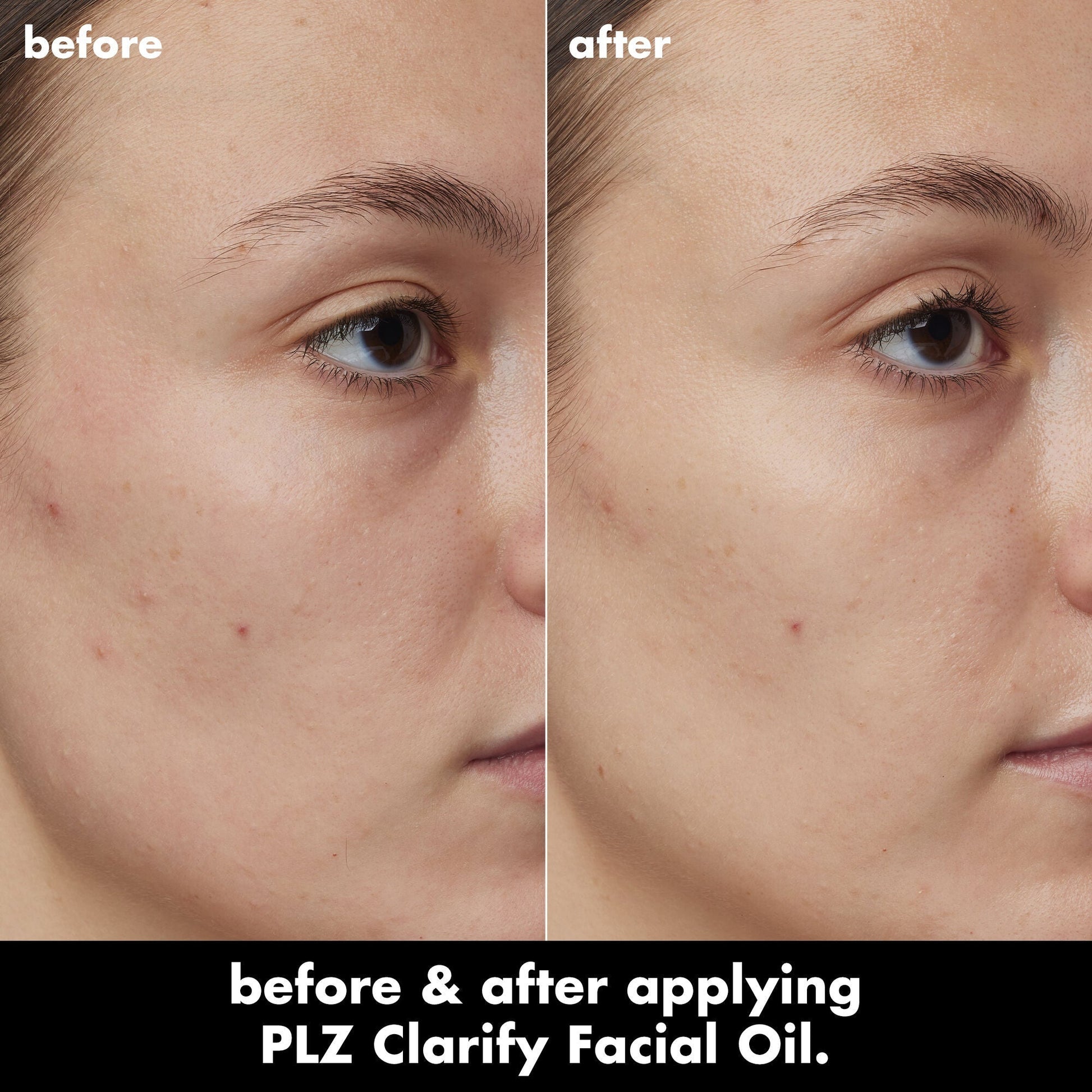 plz-clarify-facial-oil-o5 0326_EDU_PlzClarify_BA_Kelly.jpg