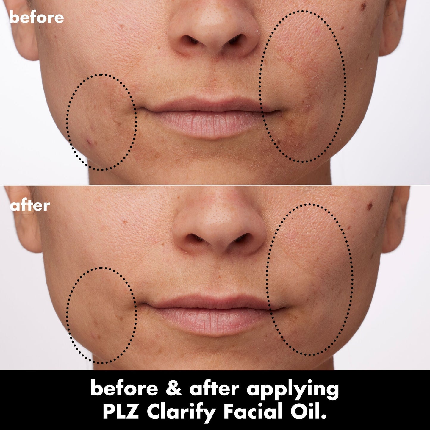 plz-clarify-facial-oil-o5 0326_EDU_PlzClarify_BA_Paula.jpg
