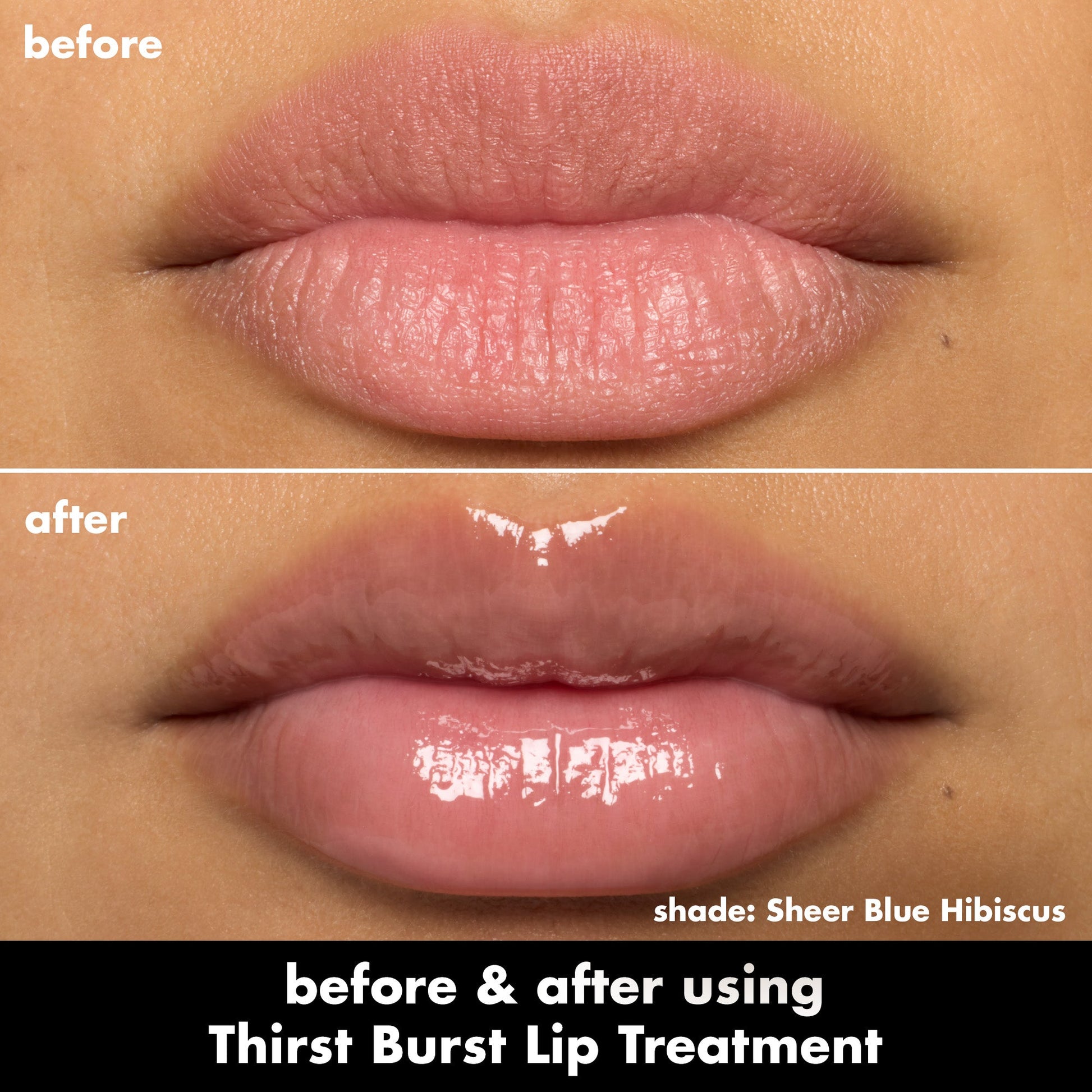 thirst-burst-lip-treatment-q3 0526_SEO_ThirstBurstLipTreatment_BA_SheerBlueHibiscus.jpg