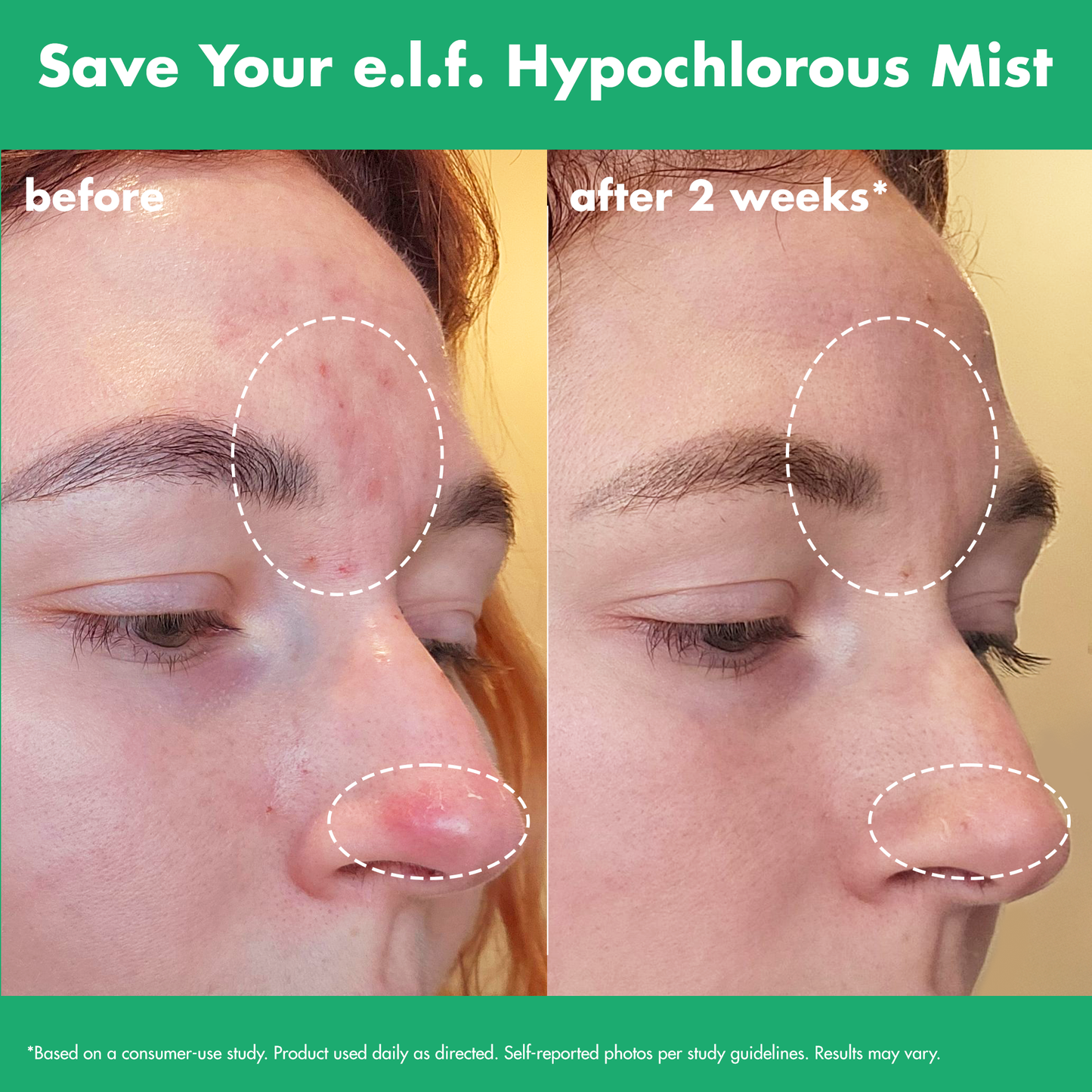 save-your-e-l-f-hypochlorous-mist-s1 FA26_EDUCATION_SAVEYOURELF_USAGE_BA1_WITHOUT_CLAIMS.png